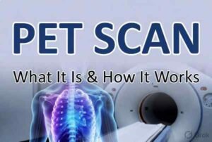Basic Principle of PET Scan