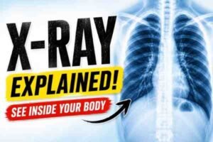 What is X-ray & it's importance