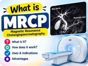 What is MRCP Test ?